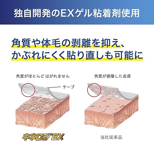 NITREAT ニトリート キネロジEXブリスター 50mm NKEXBP50