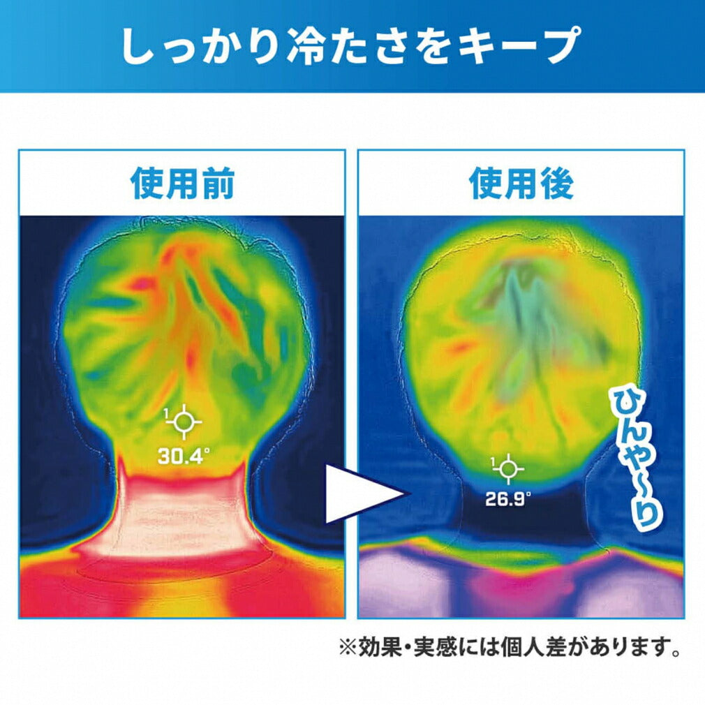 UCOOL ユークール 氷嚢 氷のう 熱中症対策  アイスネックリング アイシング 氷嚢 ゴルフ ネックアイスバッグ  ネッククーラー アイシング クールダウン ハンズフリー U型 首 屋外 観戦 大口径 首掛け 暑さ対策 夏対策 熱中症対策 グッズ 猛暑対策 (ブルー) 3377
